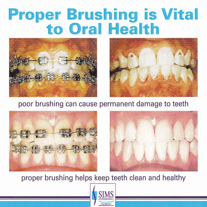 Oral Health